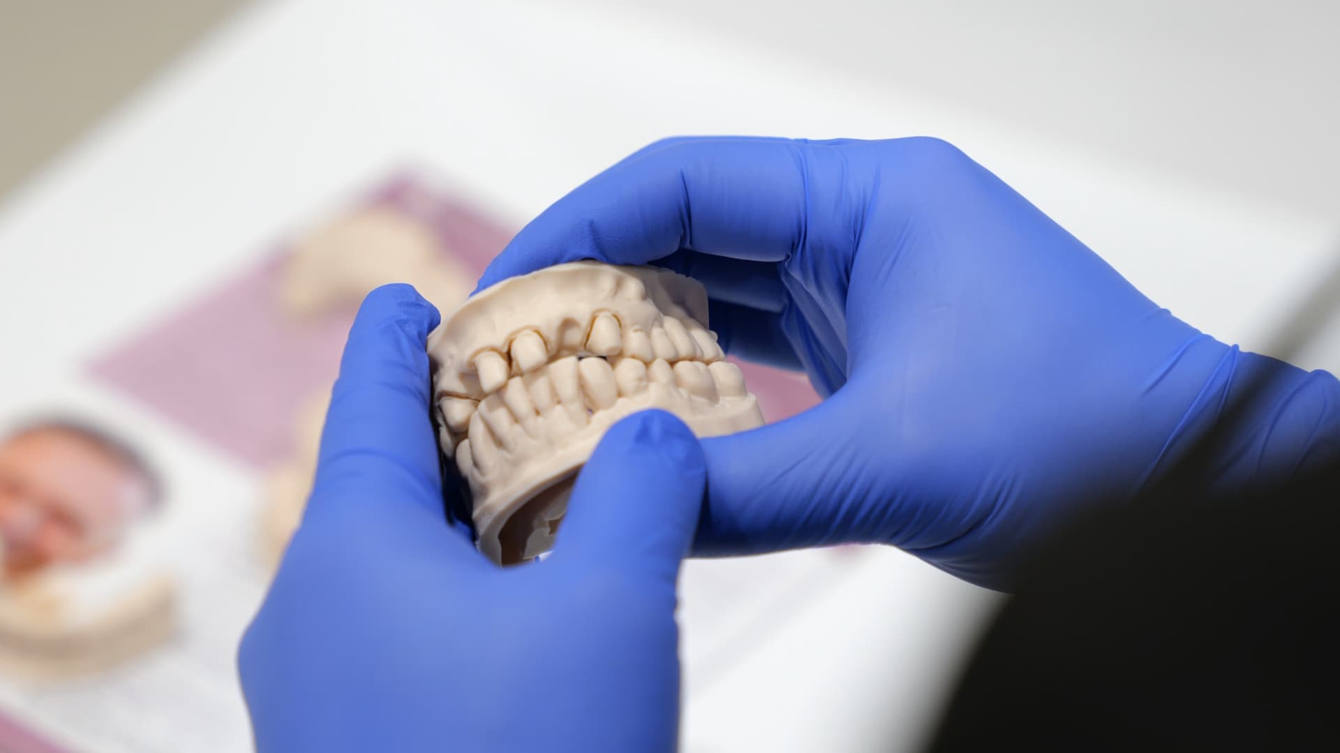 Dentist assessing teeth shape and proportion during consultation – ArtSmiles Gold Coast