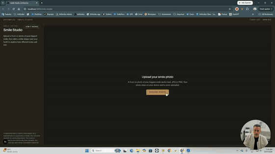 Uploading a front-on smile photo into the Smile Studio